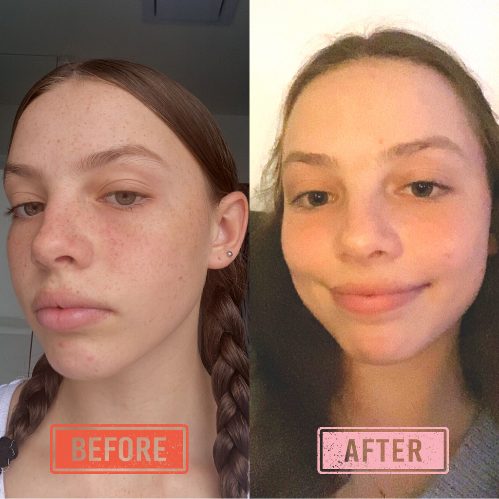 Billie NZ - Review by Emelia Reid