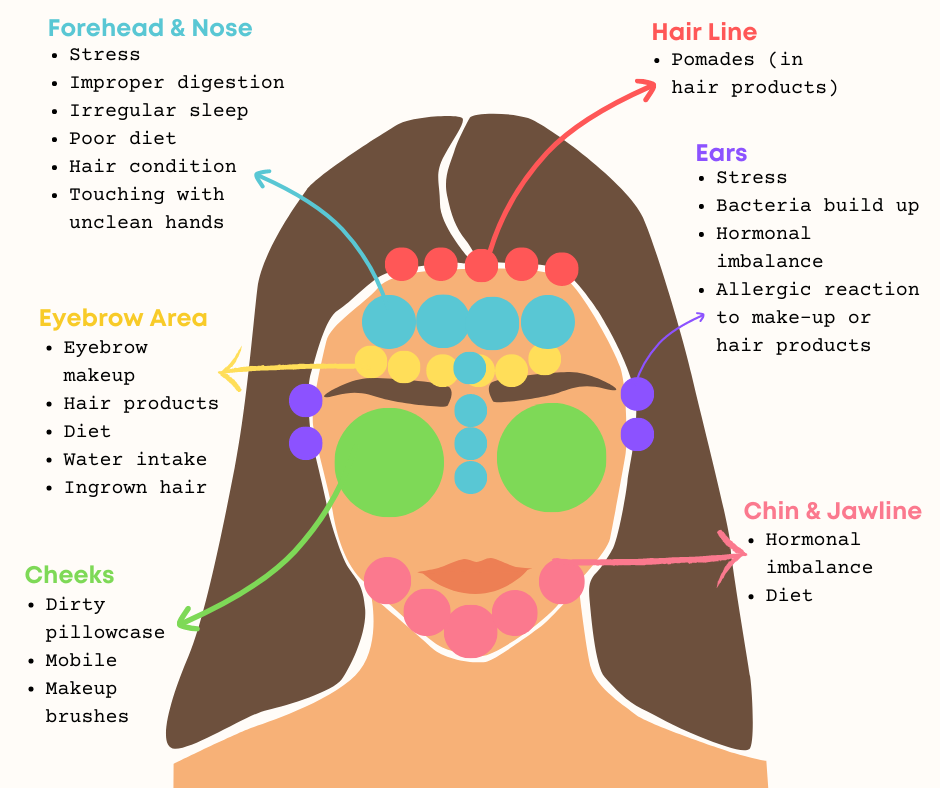 Pimples and Face Map Help